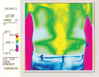 Back thermography before using Mirotec