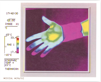 Mirotec thermography image 2