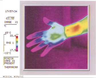 Mirotec thermography image 3